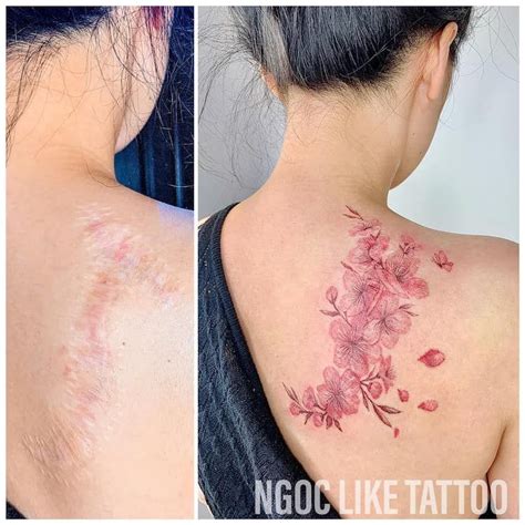 50 Times People Asked To Cover Up Their Scars And This Tattoo Artist Nailed It New Pics Artofit