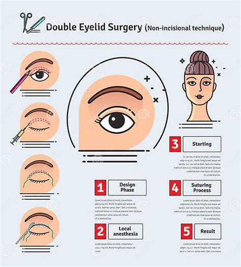 Vector Illustrated Set With Double Eyelid Surgery Non Incisional