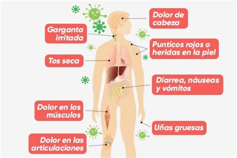 12 Síntomas De Sida Y Cómo Saber Si Tiene La Enfermedad Tua Saúde