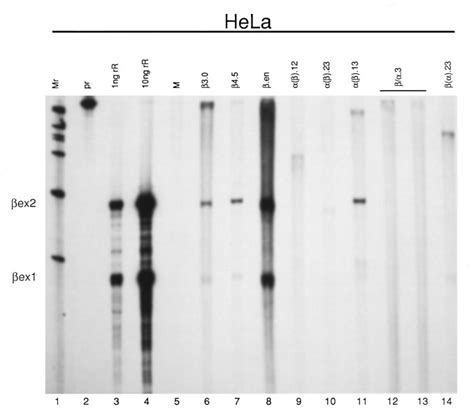 Flanking And Intragenic Sequences Regulating The Expression Of The