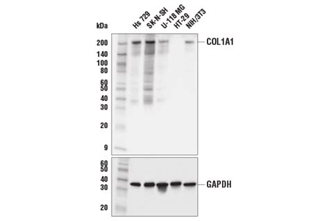 COL1A1 E8F4L XP Rabbit MAb BSA And Azide Free Cell Signaling