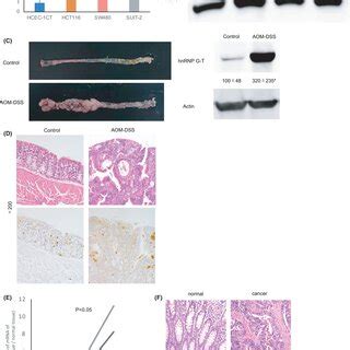 HnRNP GT Promotes Cell Growth And Inhibits Apoptosis In Colorectal