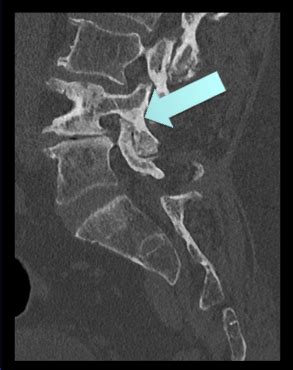 Question 40 MRI Online