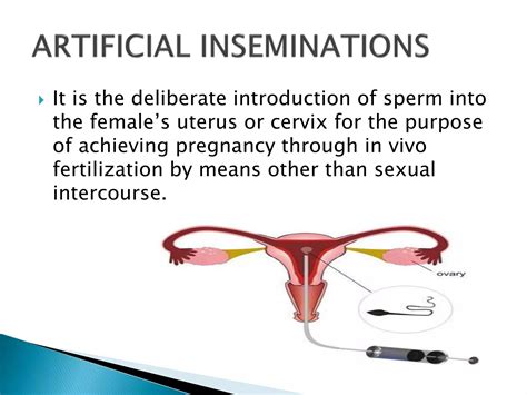 Artificial Reproductive Technology | PPTX