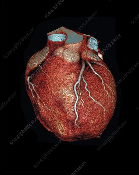 Human Heart Ct Scan Stock Image C025 6829 Science Photo Library