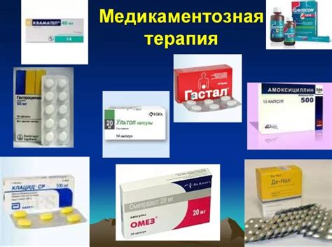 Лучшие аналоги Париета на 2025 год