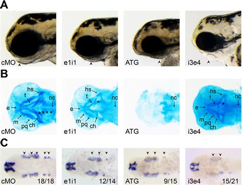 Figure From Papp A Modulates Development Of Cranial Cartilage And