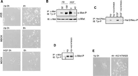 Figure From Helicobacter Pylori Caga Protein Targets The C Met