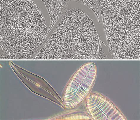 Basic Microscopy Concepts Phase Contrast Adjustment And Motic Microscopes