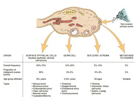 Ovarian Tumors Classification I Tumors Arising From The Surface