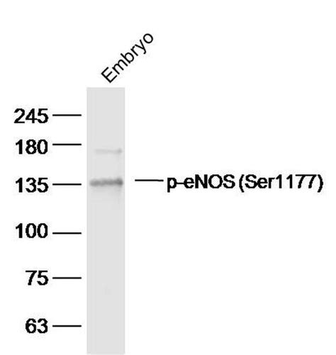 Phospho Enos Ser1177 Polyclonal Antibody Bs 3447r