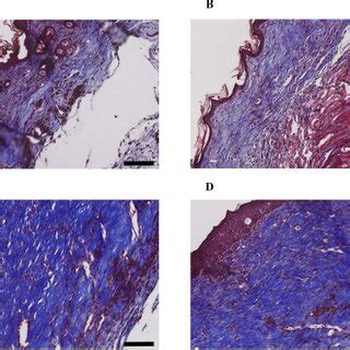 Hematoxylin And Eosin Staining Of Skin Biopsies Showing Wound Healing