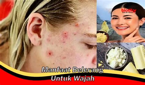 Temukan Manfaat Belerang Untuk Wajah Yang Jarang Diketahui Biotifor