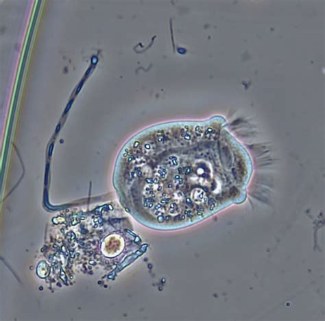 4 Main Groups Of Protozoa Owlcation