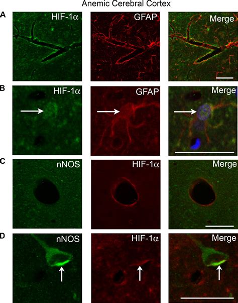 Increased Expression Of Hif Nnos And Vegf In The Cerebral Cortex