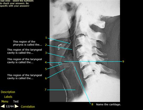 Head And Neck Larynx Lateral View 12 Diagram Quizlet