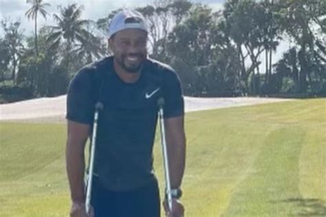 Tiger Woods posts first picture of himself since Feb. 23 car accident ...