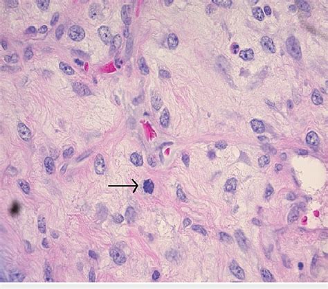 Hematoxylin And Eosin Stain 400x Magnification One Mitosis Arrow Download Scientific