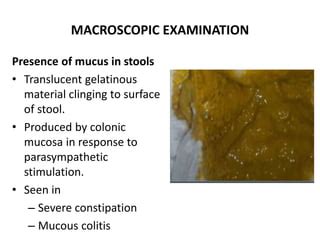 Mucoid Diarrhea