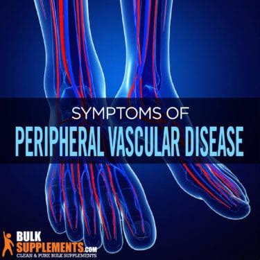 Peripheral Vascular Disease: Symptoms, Causes & Treatment