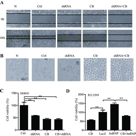 e Regulation of cell migration and proliferation by hnRNPA2/B1. (AeC ... 