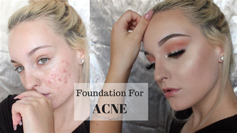 Mac Makeup For Acne Scars Saubhaya Makeup