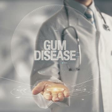 The 3 Stages of Gum Disease Explained | Marin CA