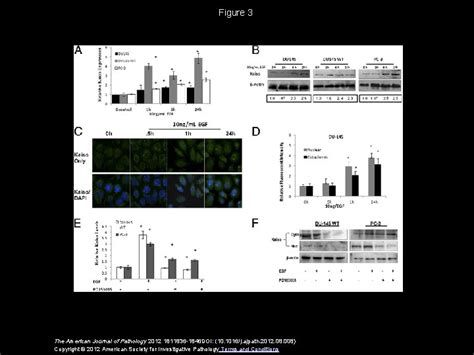 Nuclear Kaiso Indicates Aggressive Prostate Cancers And Promotes