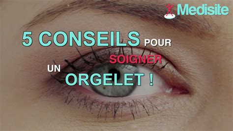 Conseils Pour Soigner Un Orgelet Youtube