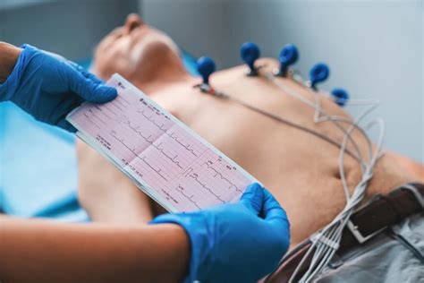 Electrocardiograma qué es cómo se hace y preparación Tua Saúde