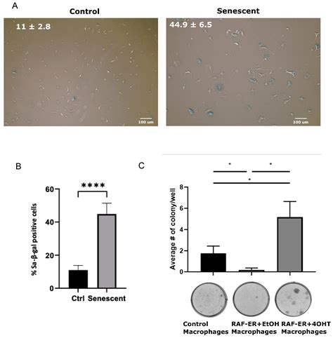 Biomedicines Free Full Text Senescent Macrophages Release