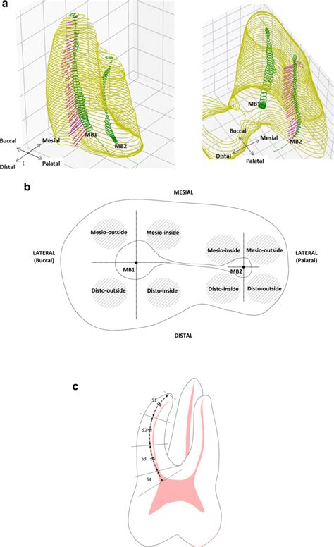 A Digital 3D Model Of A Mesiobuccal MB Root With Re Sliced Planes