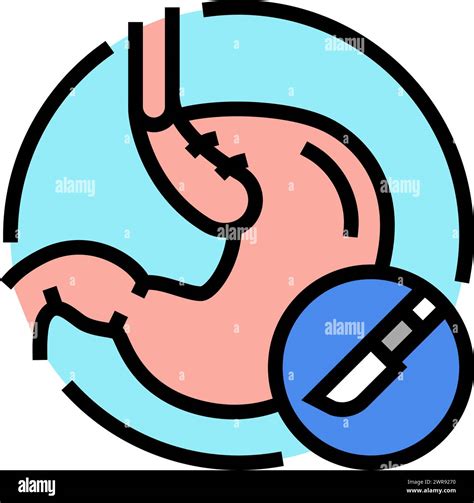 Nissen Fundoplication Surgery Color Icon Vector Illustration Stock