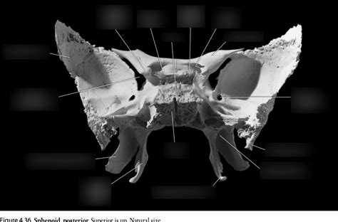 Anth 414 Quiz 1 Sphenoid Bone Superior View Diagram Quizlet