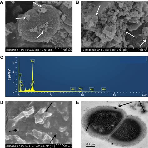 Sem Edxa And Tem Analysis Of Aunps Synthesized By Deinococcus