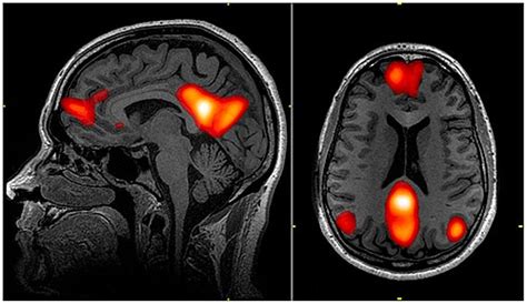 Default Mode Network Wikiwand