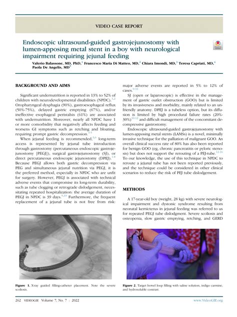 Pdf Endoscopic Ultrasound Guided Gastrojejunostomy With Lumen