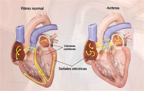 Health Condition Symptoms Causes Treatment And More