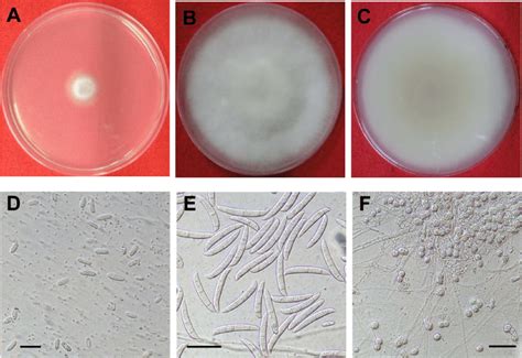 Morphological Characteristics Of Fusarium Solani A 2 Day Old Colony