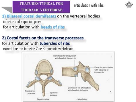 Ppt Vertebral Column Ribs And Sternum Powerpoint Presentation Id2081051