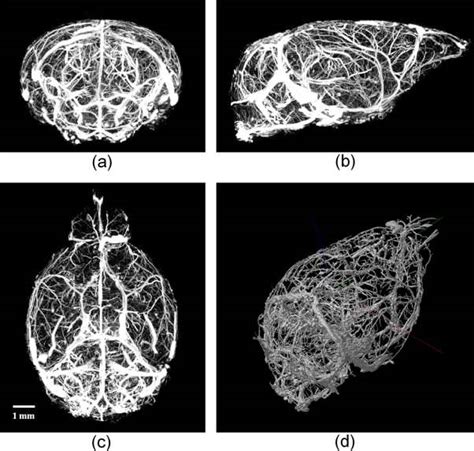 Maximum Intensity Projections MIP And 3D Rendering Of The Micro CT