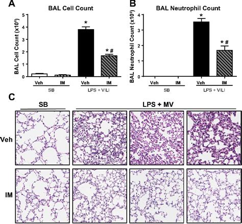 Figure From Imatinib Attenuates Inflammation And Vascular Leak In A