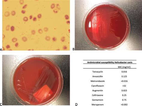 A Gram Stain Of The Blood Culture Bottle From Patient 2 Showing Curved