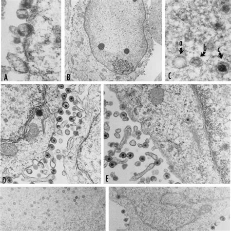 Electron Micrographs Of Cells Infected With Wild Type HSV 1 F U L 31