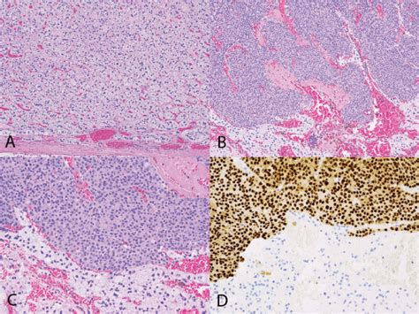 Histological Findings Of The Patient A Hematoxylin And Eosin Stain Download Scientific Diagram