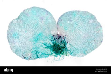 11 Fern Prothallus Microscope Jurasharai