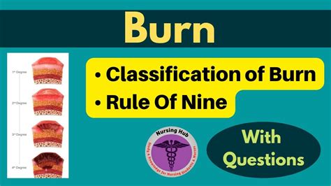 Burns Classification Of Burn Rule Of Nine For Important For