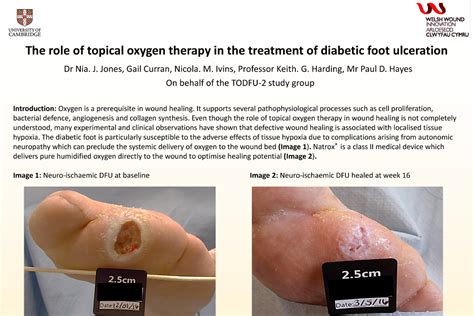 NATROX The Role Of Topical Oxygen Therapy In The Treatment Of