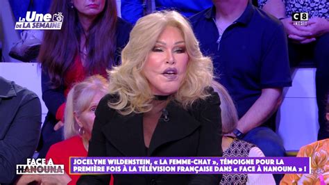 Jocelyne Wildenstein La femme chat témoigne pour la première fois à