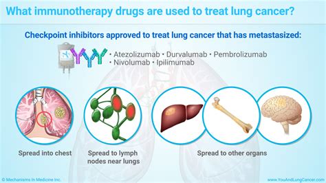 Slide Show - Understanding Immunotherapy for Lung Cancer